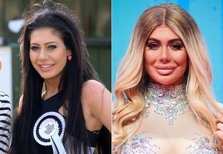 chloe ferry butt|Geordie Shore’s Chloe Ferry plastic surgery timeline.